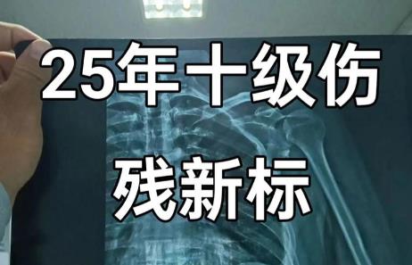 2025年十级伤残怎么判刑和赔偿标准